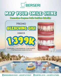Read more about the article Promo Bleaching
