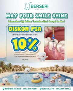 Read more about the article Promo PSA (Perawatan Saluran Akar)