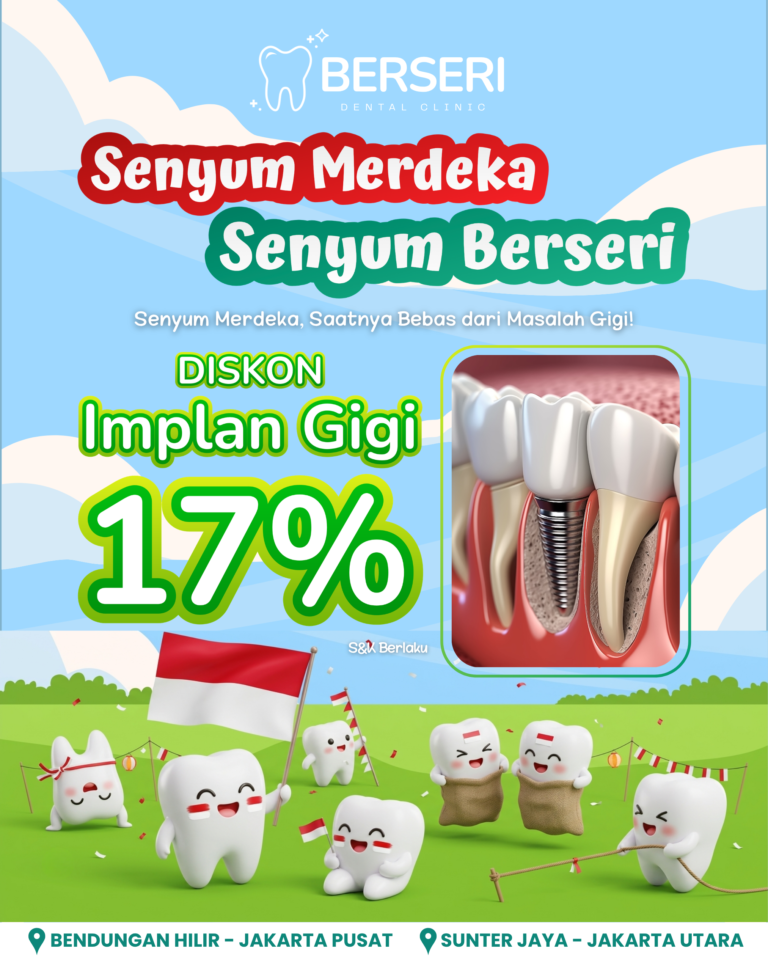 DISKON IMPLAN GIGI – 17%
