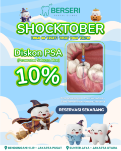 Read more about the article SHOCKTOBER Diskon PSA 10%