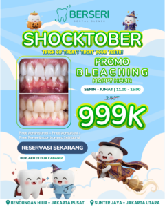 Read more about the article SHOCKTOBER Promo Bleaching 999K