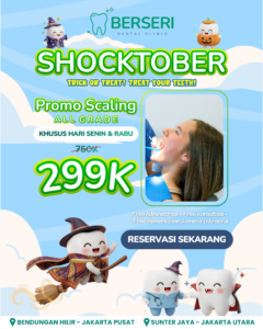 Read more about the article SHOCKTOBER Promo Scaling All Grade 299K