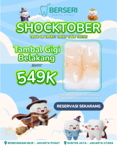 Read more about the article SHOCKTOBER Promo Tambal Gigi Belakang